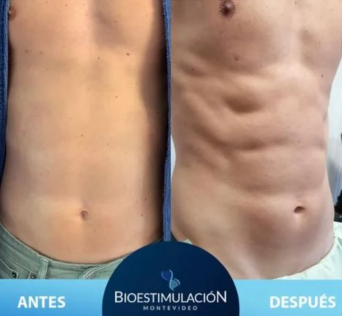 Resultado de nutrición personalizada - Bioestimulación