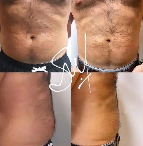 Resultado de plan nutricional - Bioestimulación